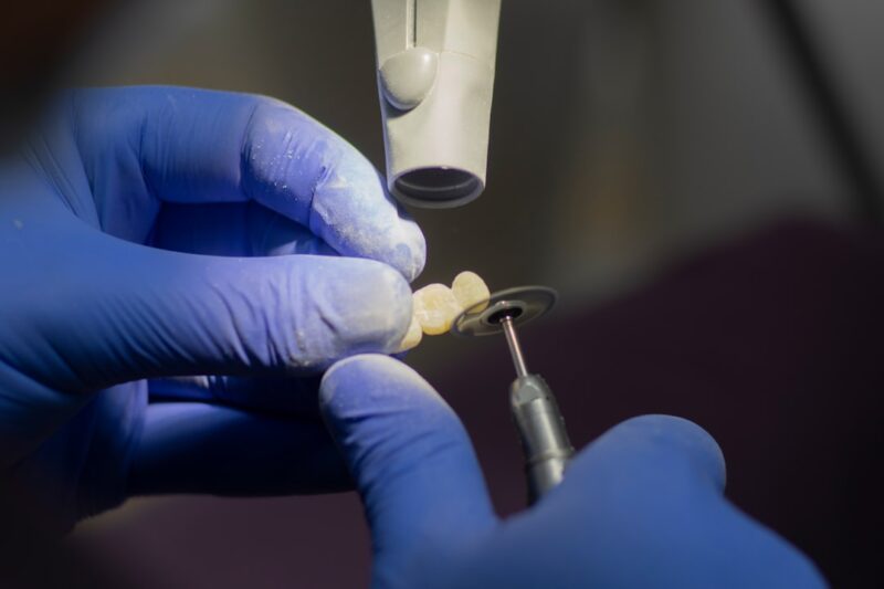 Las Vegas Emergency Dentist: Quick Relief for Dental Emergencies